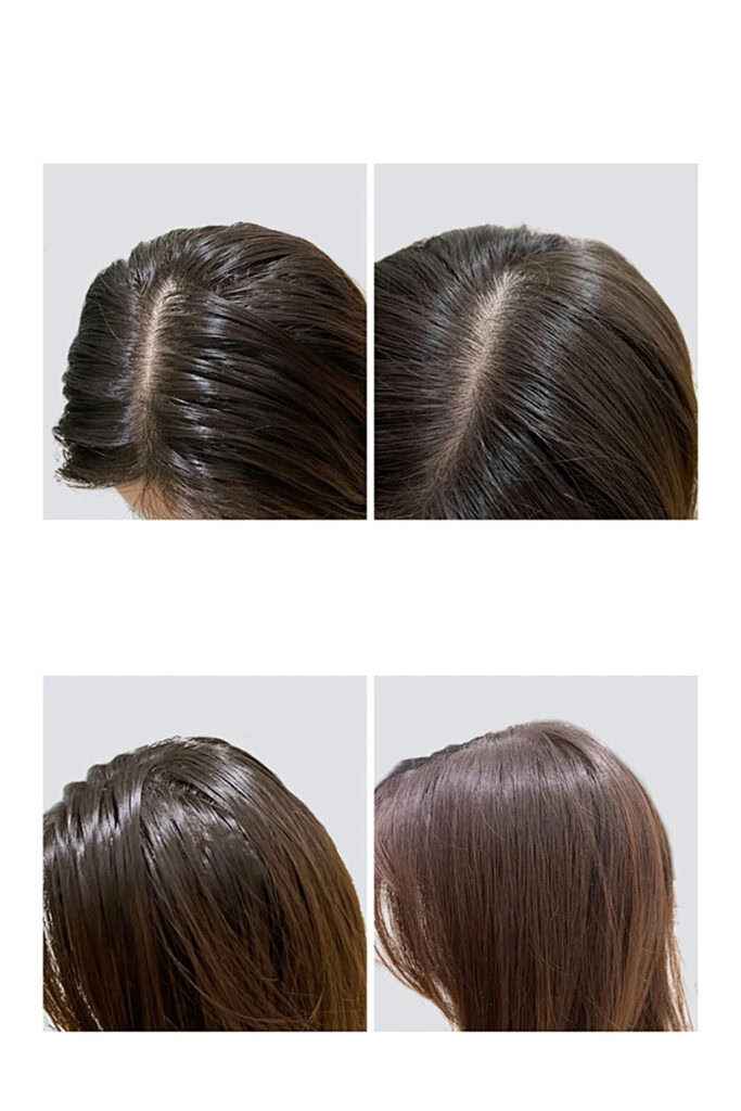 Dry Shampoos 9