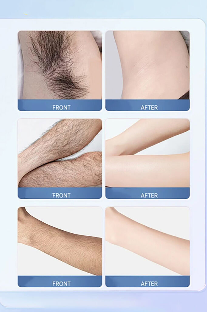 Hair Removal Sprays 4
