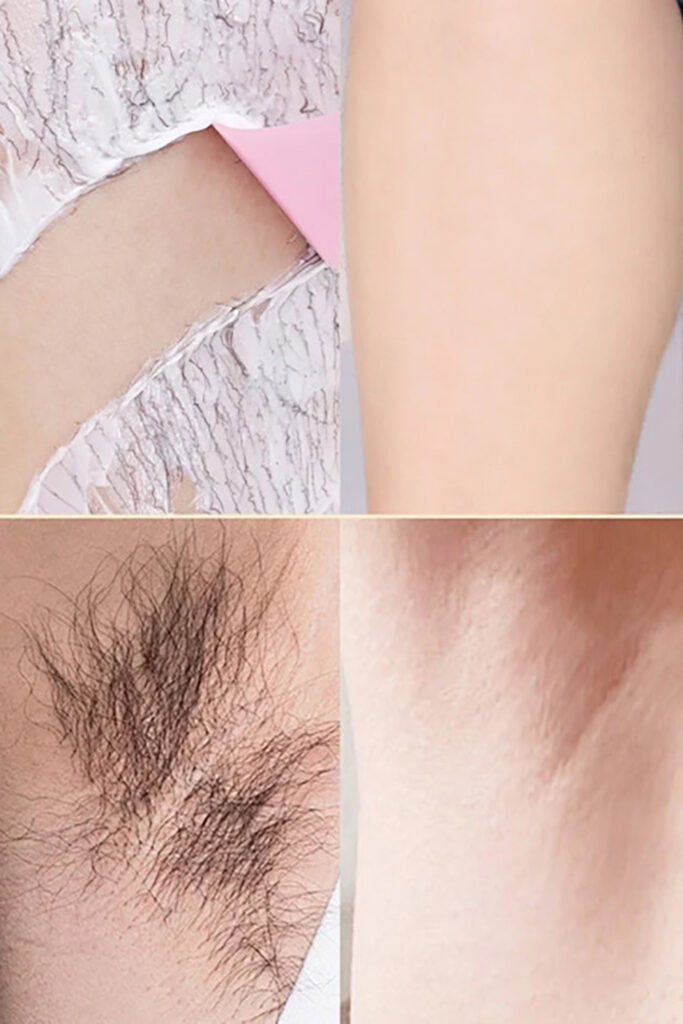 Hair Removal Sprays 7