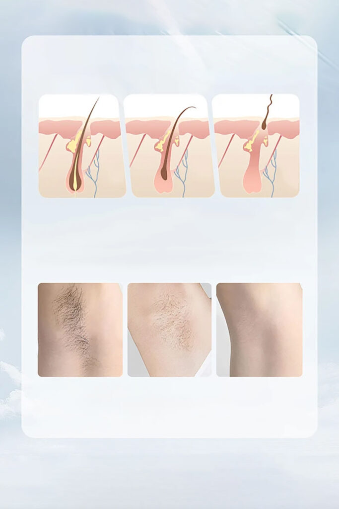 Hair Removal Cream 6