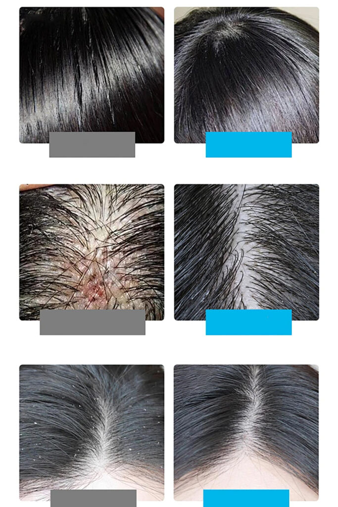 Scalp Scrub 5
