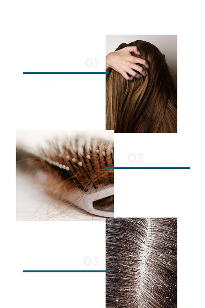 Scalp Scrub 6
