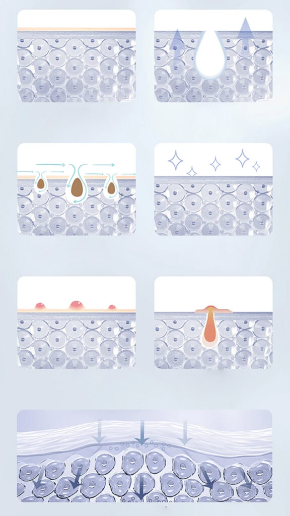 Anti Acne 18