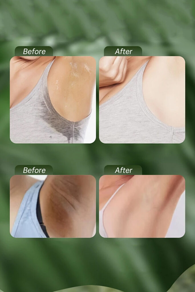 Anti Perspirant 4