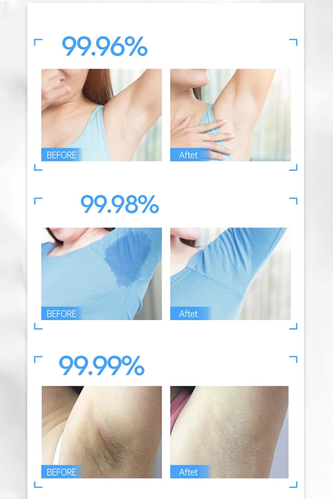 Anti Perspirant 5