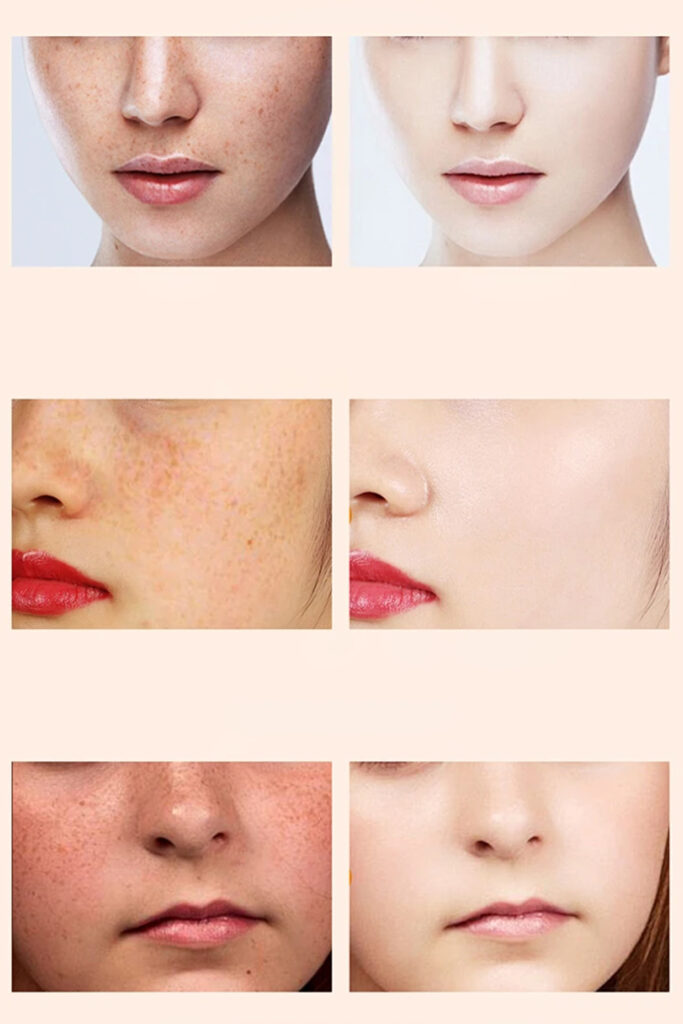 Whitening Facial Serum 3